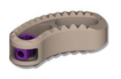 Кейдж міжхребцевий TLIF PEEK 26х10х8, кут лордозу 5 градусів